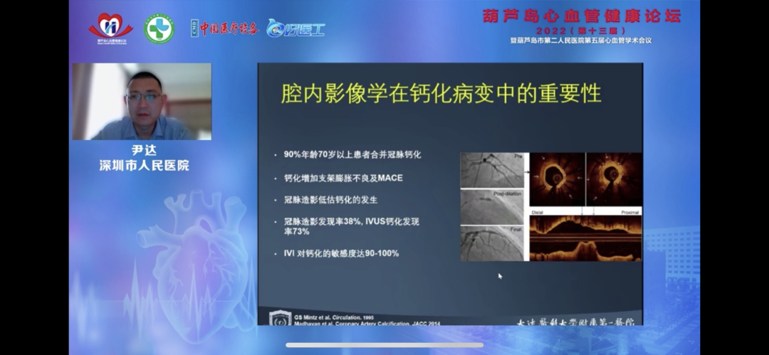 葫蘆島心血管健康論壇?2022｜創(chuàng)新驅(qū)動發(fā)展，不斷提升心血管疾病救治能力(圖11)
