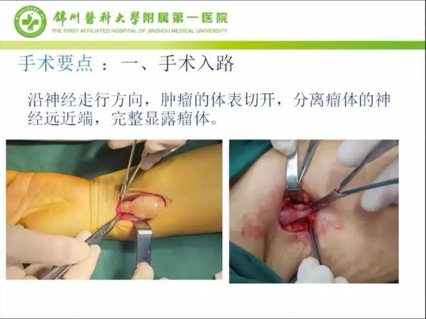 聚焦顯微外科|葫蘆島市醫(yī)學會顯微外科學分會第一屆第二次學術會議順利召開(圖13)